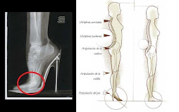 ¡ATENCION!  MAXIMO ACONSEJABLE DE TACO 7,5 CM.