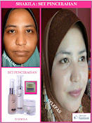 Testimoni Set Pencerahan + Treatment Cream