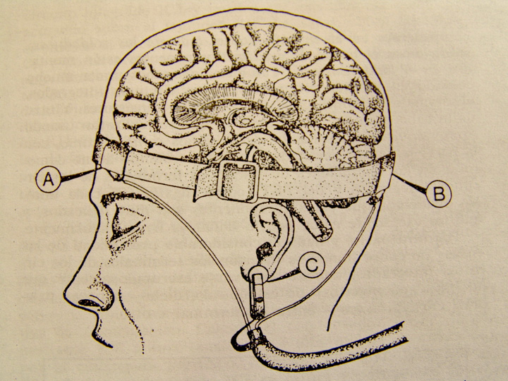 The Neurocritic What Is This Thing Called Neuroscience?