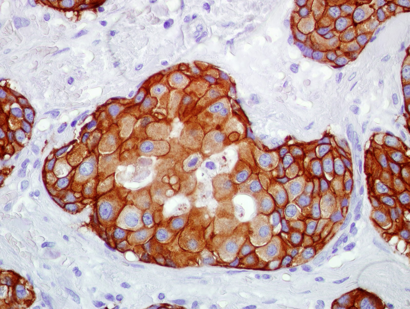 LABORATORIO DE INMUNOHISTOQUÍMICA