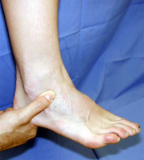 Healthy and Beauty Tips: Treatment for Ankle Pain | Ankle Pain Relief