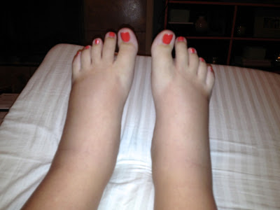 swollen pounds feet lost hated second every september