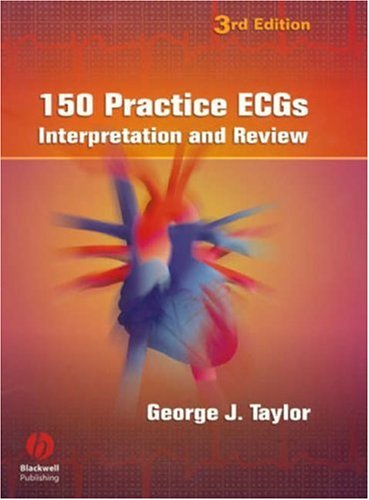 150 Điện tâm đồ thực hành: Giải thích và Ôn tập