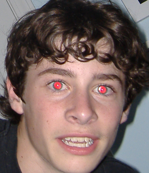 universitysettlementphoto images for RED EYE REMOVAL