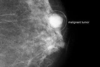 نقره لتكبير أو تصغير الصورة ونقرتين لعرض الصورة في صفحة مستقلة بحجمها الطبيعي