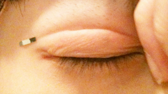 Eyelid Fiber