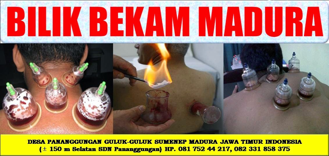 Bilik Bekam Madura (BBM)