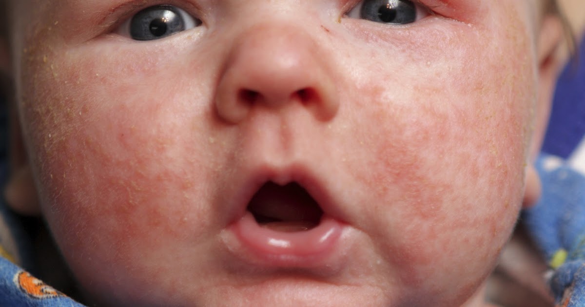 Pennsylvania Environmental Solutions Conservation, Alternative Energy