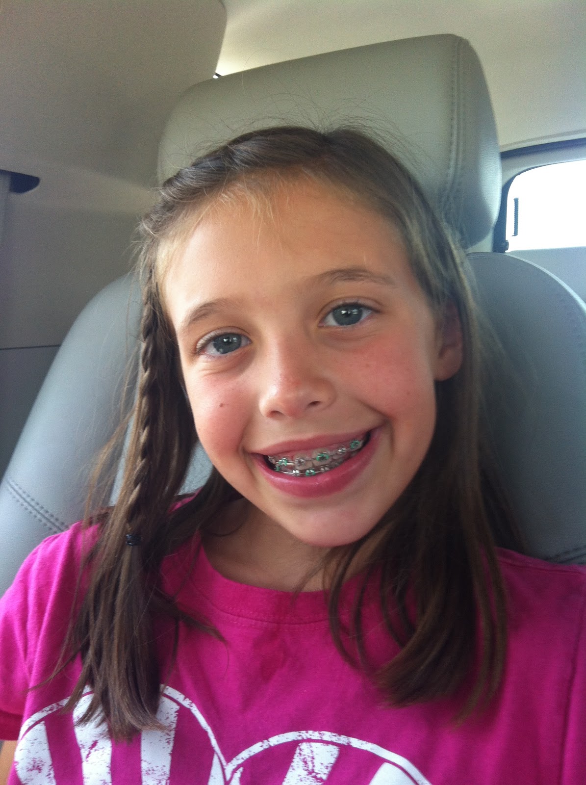 Turner Times! Bye, Bye BRACES!!!!