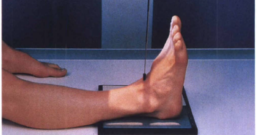 Ankle Ap Projection Radtechonduty