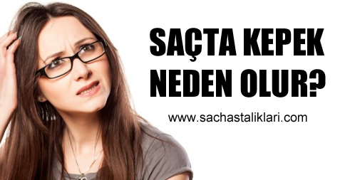 kepek sampuani uzman yorumlari blogger