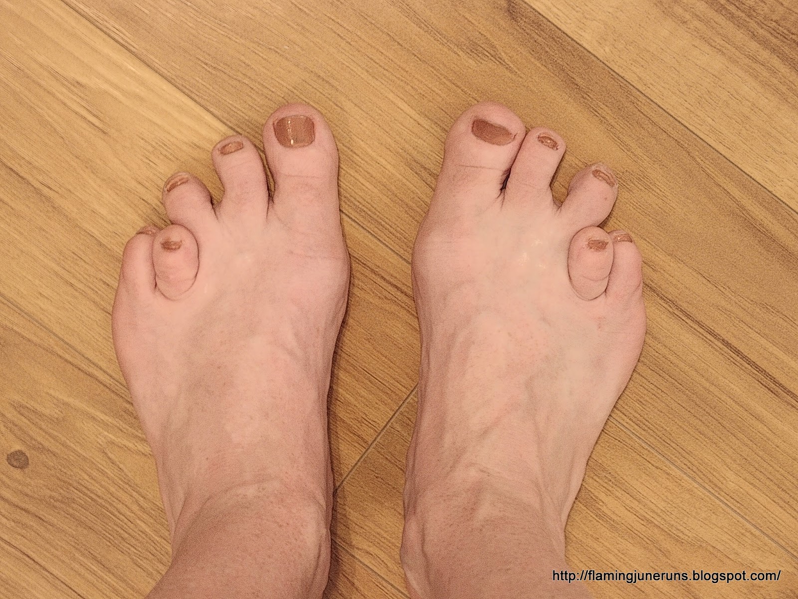 For pics sale feet ugly Fun ~