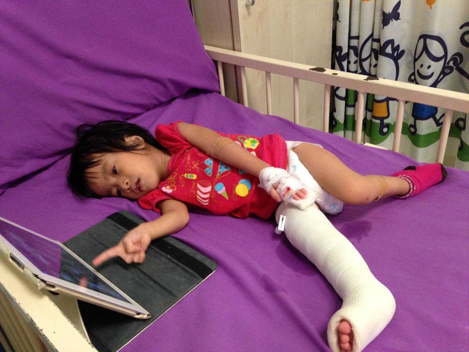 God gave us Evelyn First leg fractures