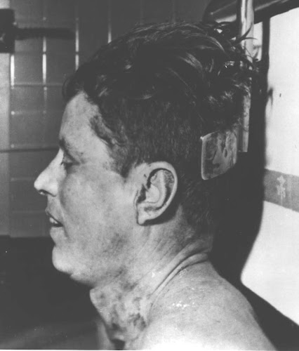 00a.+JFK+Autopsy+Photo.jpg