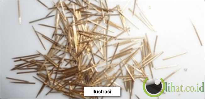 Ist