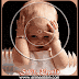 Dp Bbm Sakit Kepala thumbnail