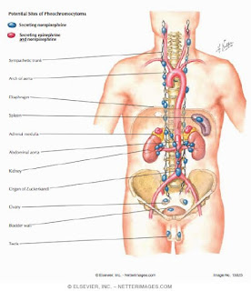 Nursing Management of Pheochromocytoma