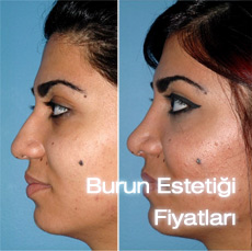 Teoman Dogan Burun Estetigi Resimleri 2018 2019 Youtube