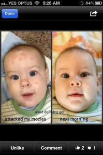 get sassy with it works global products use of defining gel in so it works greens acne