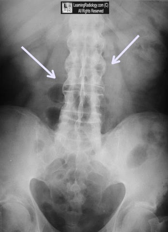 Bamboo Worktops Photos: Bamboo X Ray