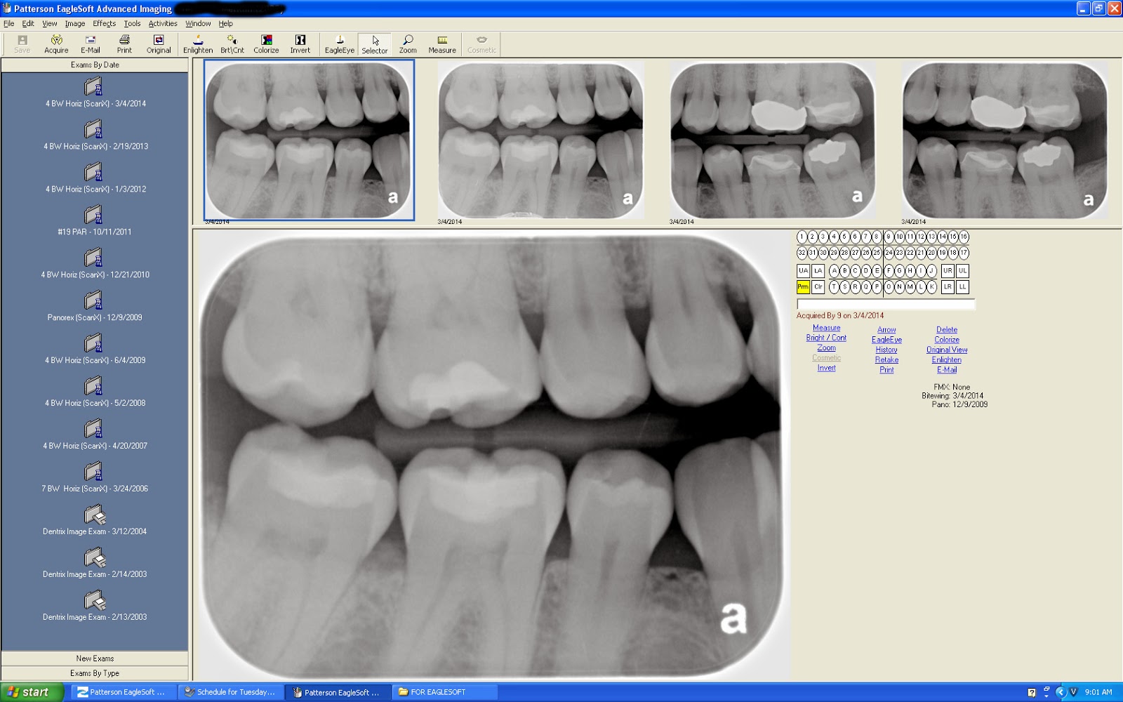 Justin Shafer Eaglesoft 16 and ScanX EPP Model (Parallel Port)