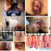 Mengobati Wasir dengan Propolis dan Ambeclear thumbnail