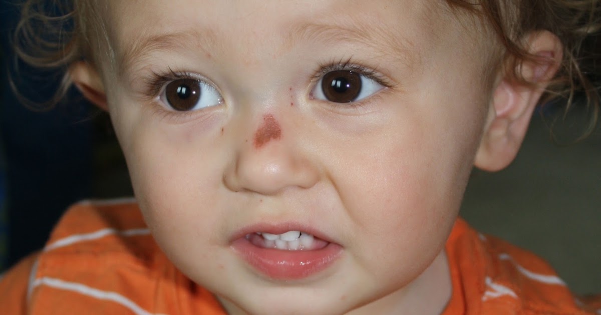 Baby McDermott Rug Burn