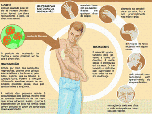 Cuidados em Casa - Conhecida popularmente como lepra, a hanseníase é uma  doença milenar, causada pela bactéria Mycobacterium Leprae e transmitida  principalmente por via respiratória. A doença, que tem cura, acomete pele