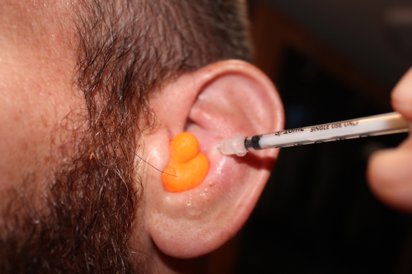 What Is Jiu Jitsu Treating Cauliflower Ear At Home