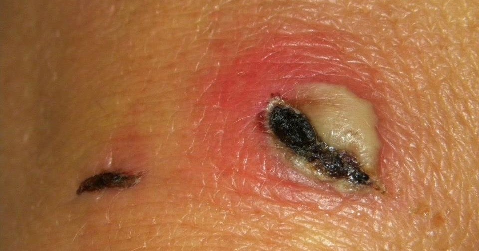 Healing Dog Wounds Naturally Healing Dog Wounds Naturally