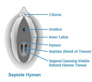 depth of hymen
