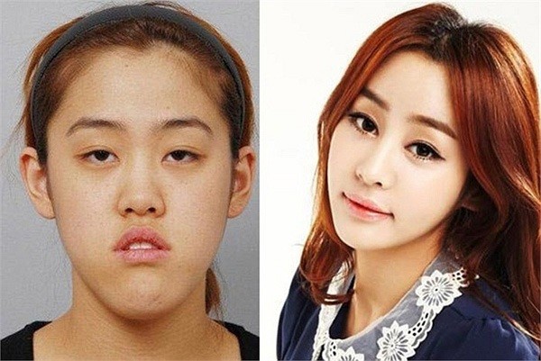 Звезды до и после Korean-girl-plastic-surgery-magic-01.