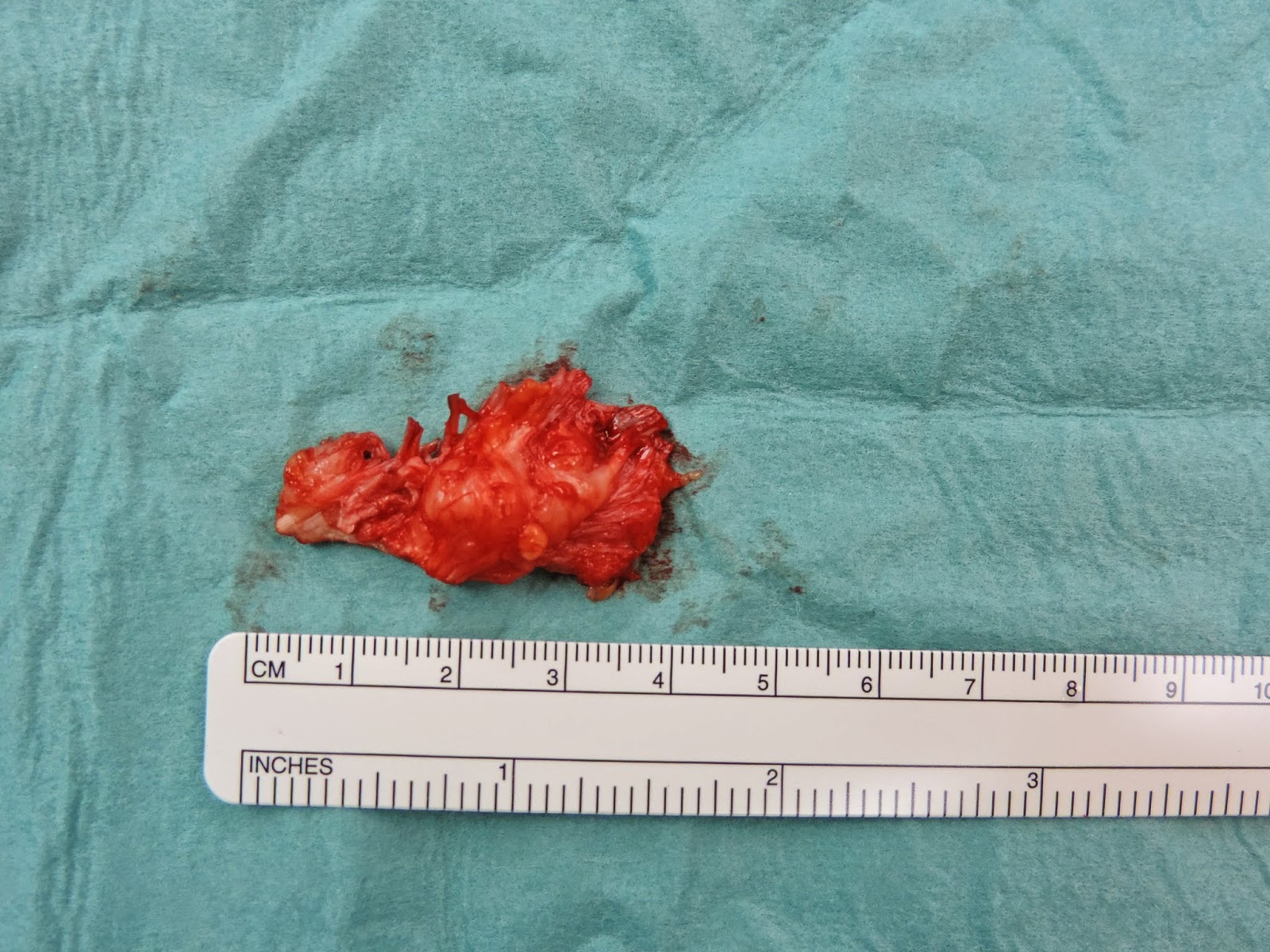 Los mejores Juegos de accin y aventura PSP - 3DJuegos