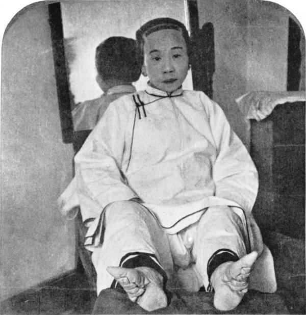 Chinese foot binding