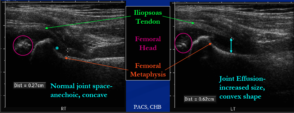 ECC EDUCATION: Pediatric Case of the Week #2: Limp