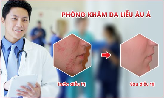 phòng khám bệnh da liễu tp hcm