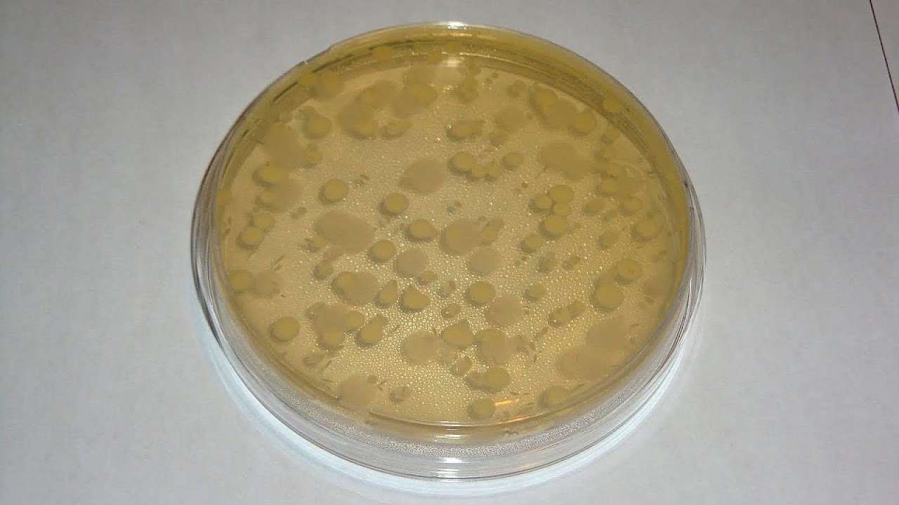 How To Count Colony Of Bacteria On A Petri Dish Dish Choices