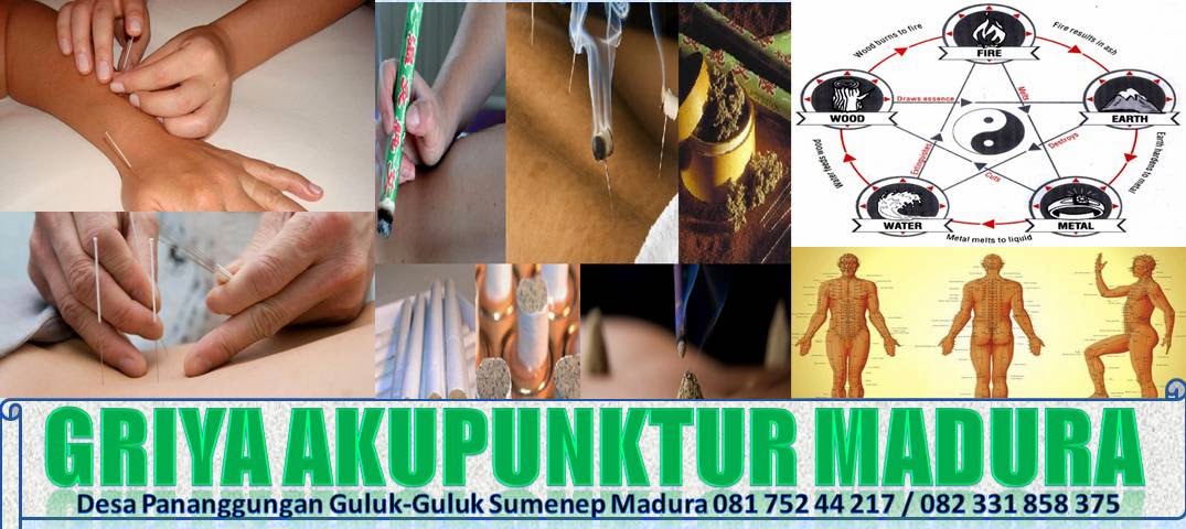 AKUPUNKTUR MADURA