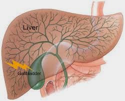 http://www.naturalbodytips.com/2014/09/natural-tips-to-reduce-gallbladder-pain.html
