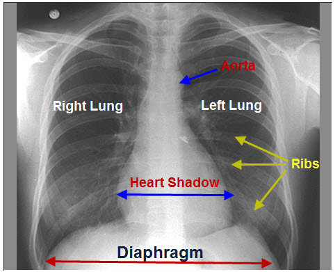 Thank you for your attention: The Man with X-Ray Eyes