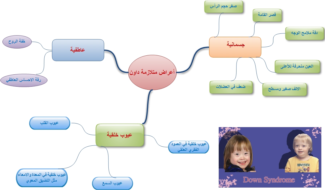 متلازمة داون Down Syndrome رسم توضيحي لأعراض متلازمة داون