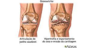 medicamento para articulação do joelho