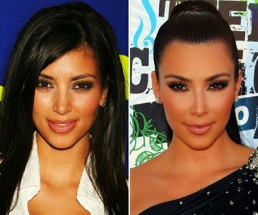 Kim Kardashian, antes y después de las cirugías! Curiosos