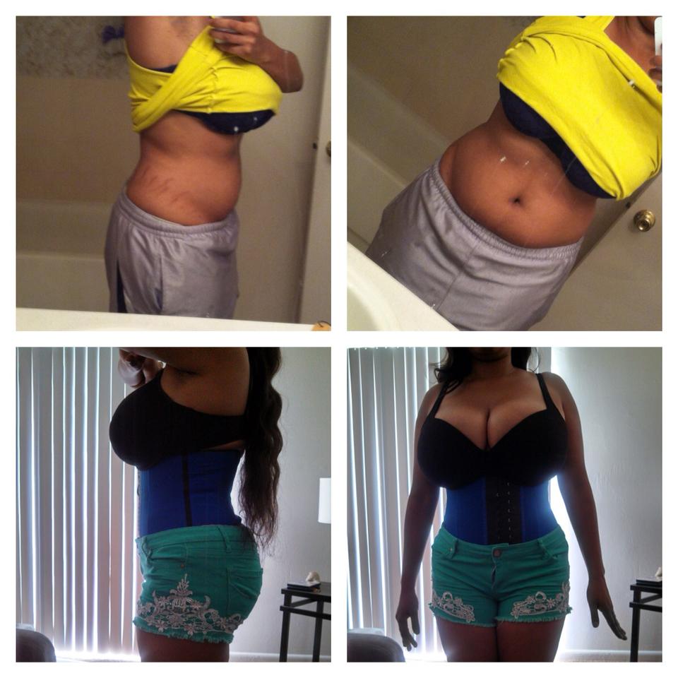 HCG Diet journey 24 hr challenge corset training