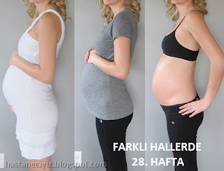 28 haftalık anne göbeği