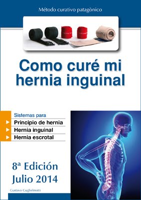 Hernia inguinal