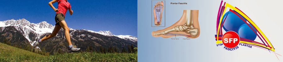 Fascitis Plantar