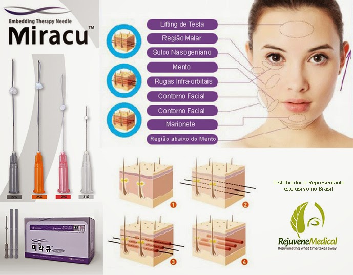 PDO Thread Lifting Miracu e Real Up RJV Blog