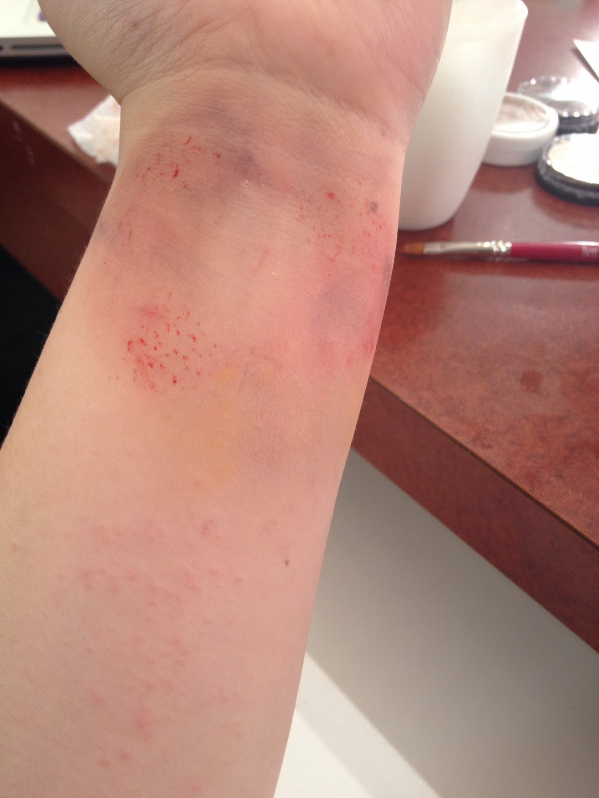 Stage Makeup Cuts and Bruises