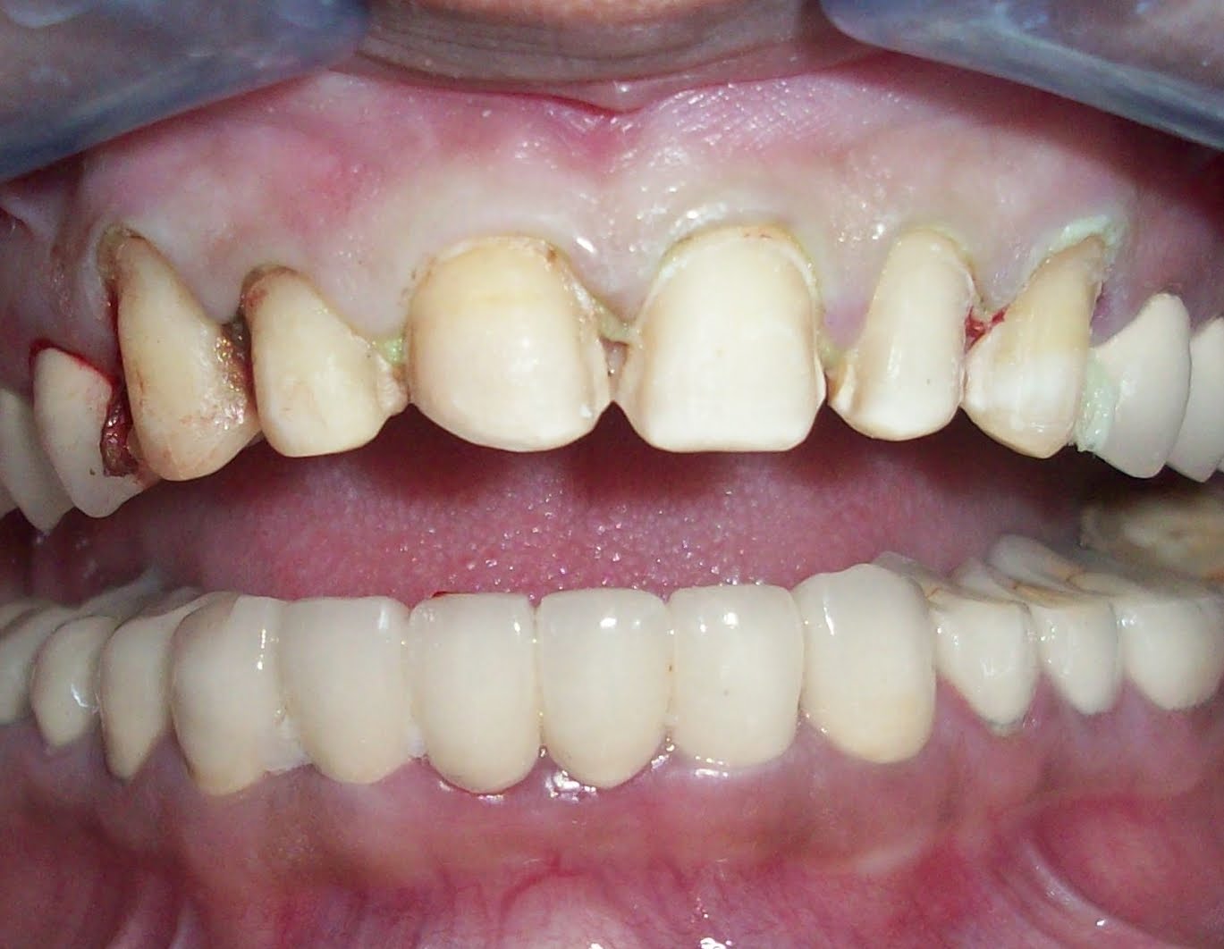 Restorative Dentistry & Endodontics